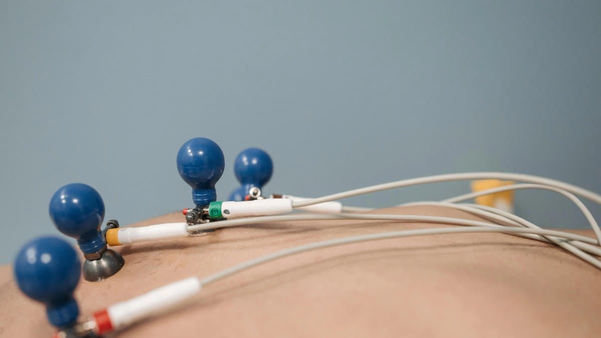 患者正在接受12导联心电图(ECG)检查