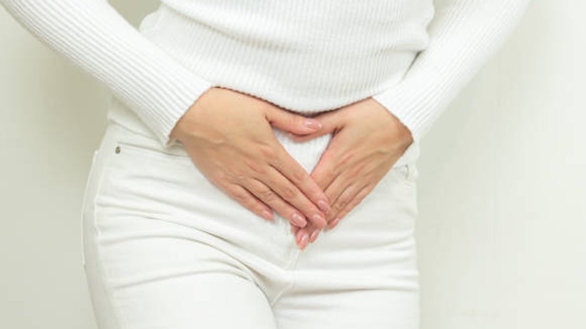Illustration showing dilated and varicose veins in the female pelvic region
