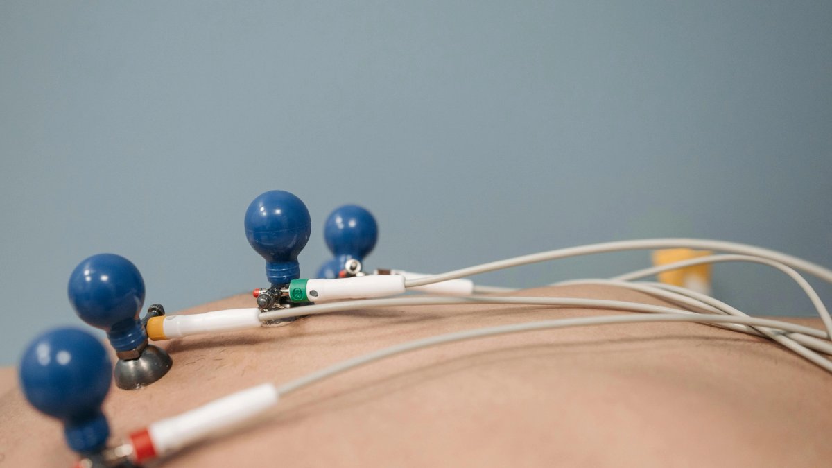 Patient undergoing a 12-lead electrocardiogram (ECG) test