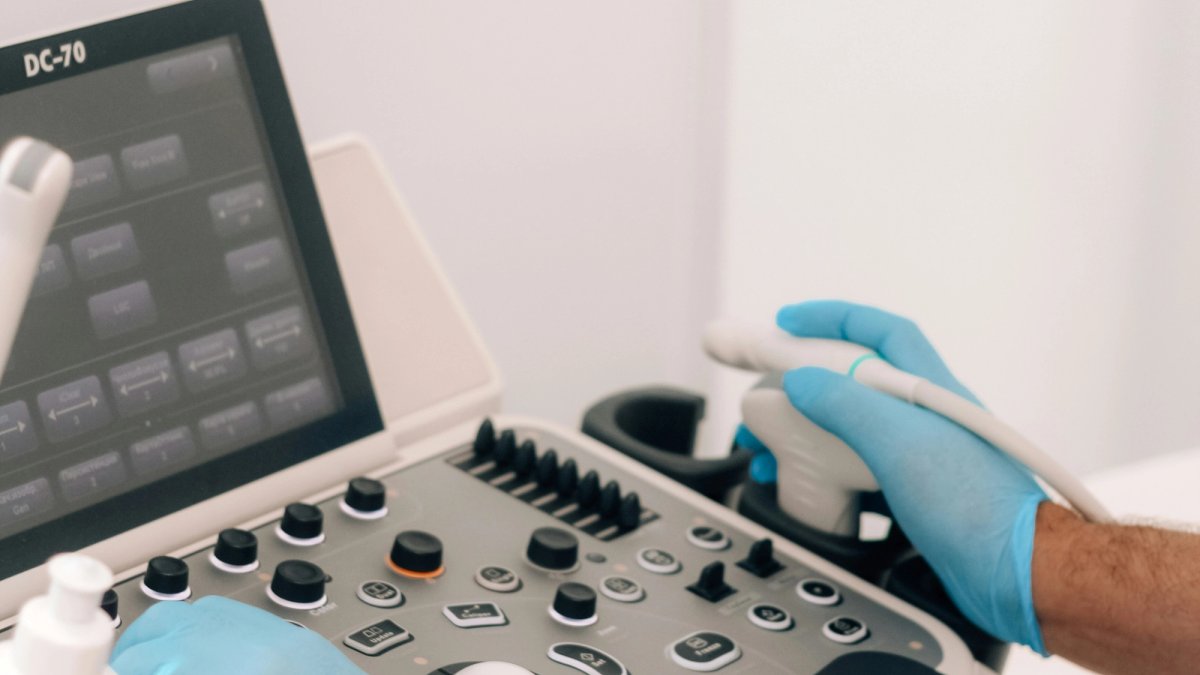 Venous reflux ultrasound test mapping the veins in a standing patient's leg
