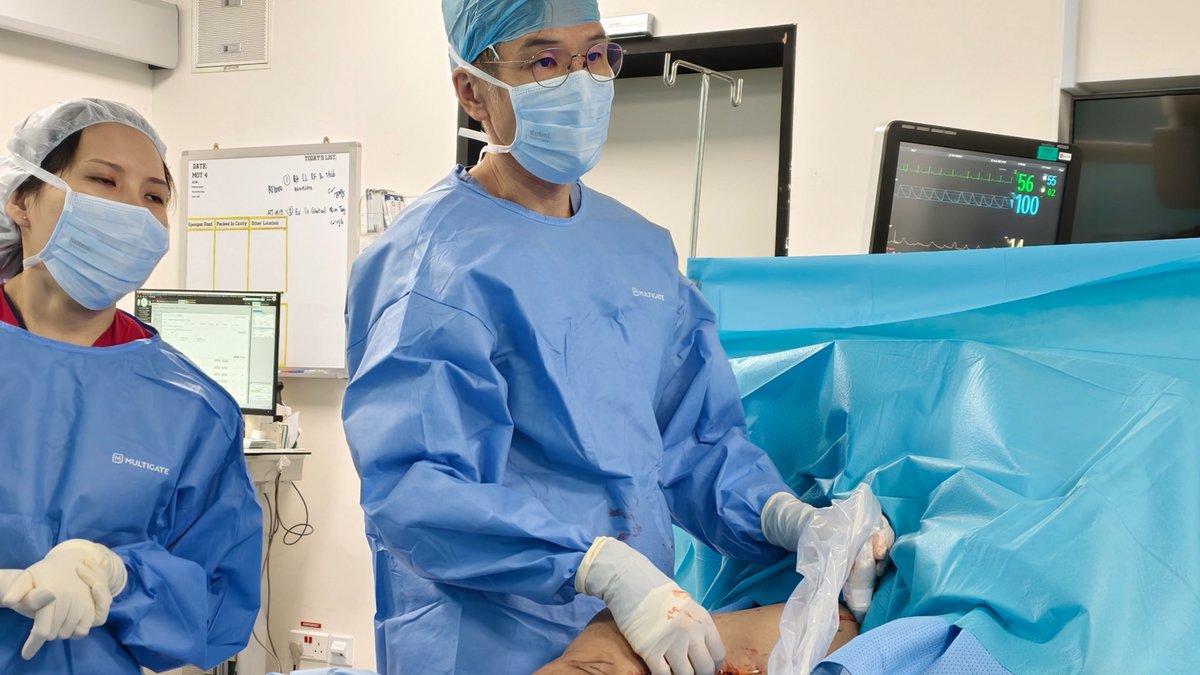 Radiofrequency catheter sealing a varicose vein using thermal energy